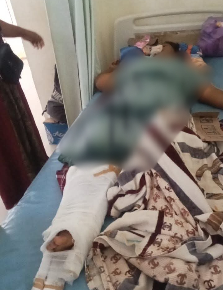 Korban Alami Patah Tulang Akibat Kecelakaan Mobil, Satlantas Polres Dompu Malah Proses Damai Tanpa Libatkan Keluarga Korban